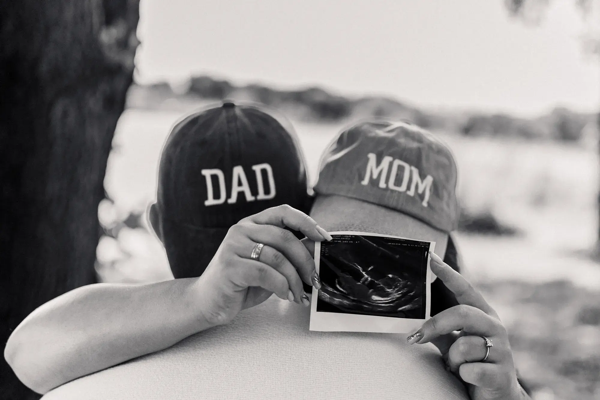 DAD és MOM feliratú sapkák az ultrahangképpel a leendő szülők kezében